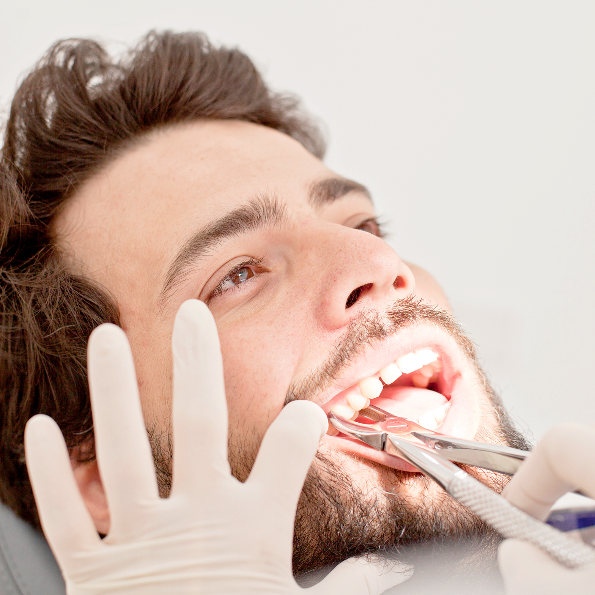 Bozeman Tooth Extractions